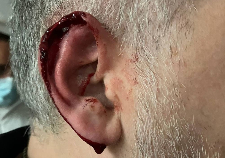 Un okupa arranca parte de una oreja de un mordisco a un policía en Valencia